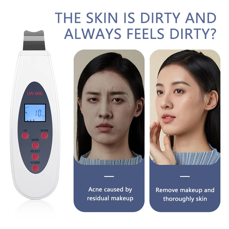 Ultrasonic Skin Scrubber Facial Deep Cleansing Machine To Remove Acne Exfoliating Blackheads Facial Massage and Lifting LW006